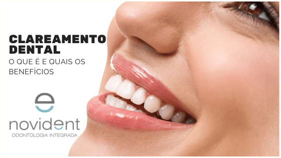 Clareamento-Dental-1