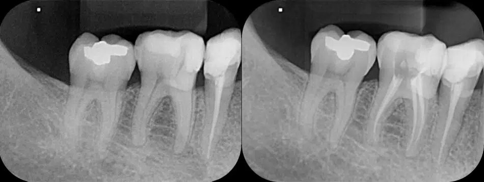 Endodontia